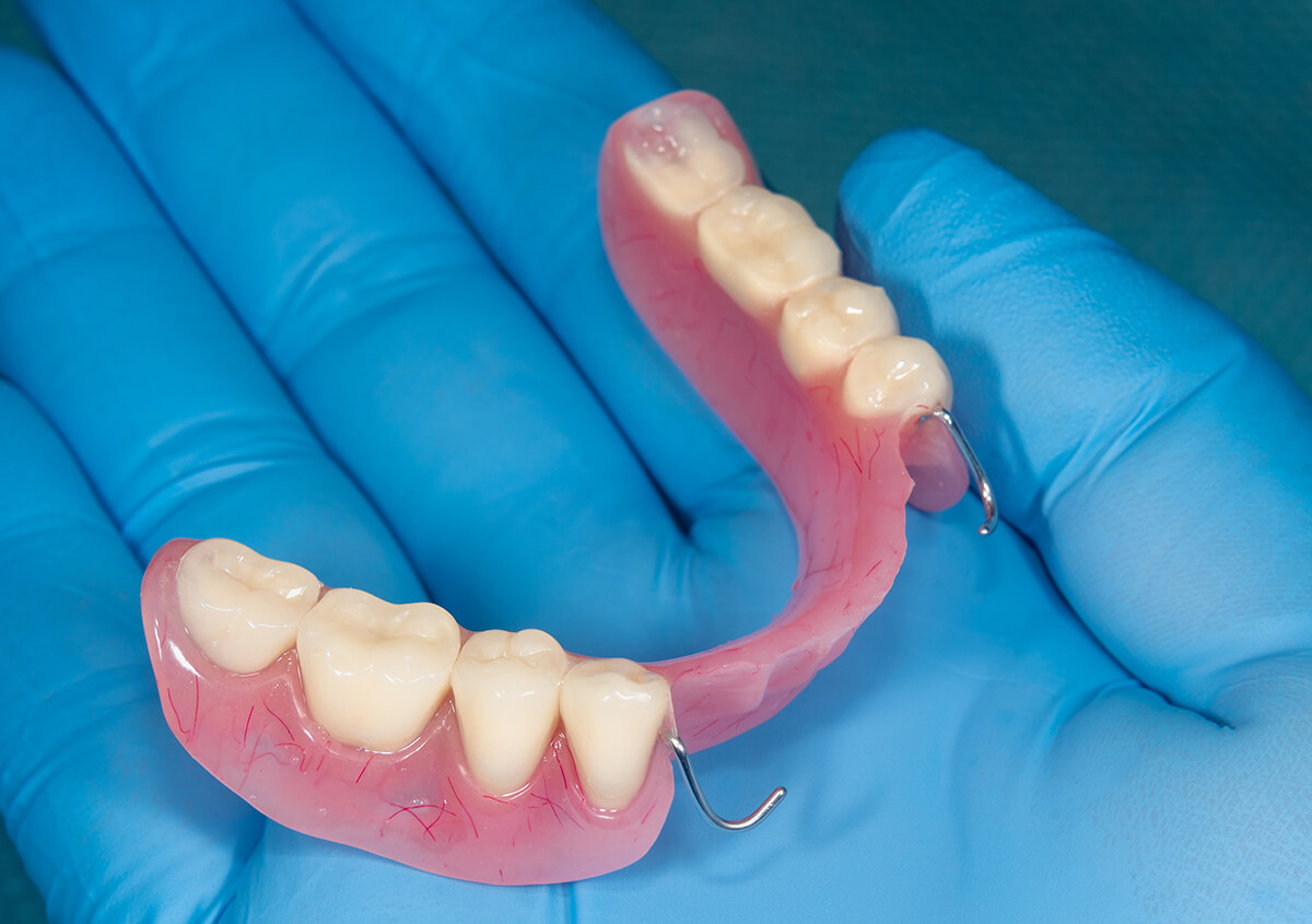 Removable Partial Dentures in Fallbrook CA Area
